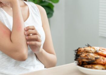 Aclarando conceptos erróneos sobre las alergias alimentarias que pueden afectar la salud